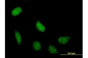 Immunofluorescence of purified MaxPab antibody to SIRT7 on HeLa cell. (SIRT7 抗体  (AA 1-400))