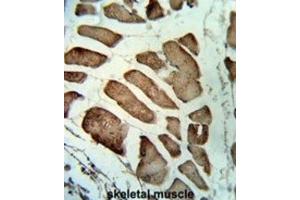 Immunohistochemistry (IHC) image for anti-Leiomodin 1 (LMOD1) antibody (ABIN3003829) (Leiomodin 1 抗体)
