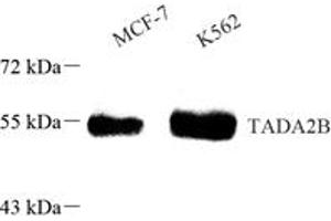 Western blot analysis of TADA2B (ABIN7075957) at dilution of 1: 1000,Lane 1: MCF-7 cell lysate,Lane 2: K562X cell lysate (TADA2B 抗体)