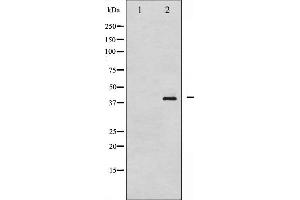 Western blot analysis of NPM phosphorylation expression in Jurkat whole cell lysates,The lane on the left is treated with the antigen-specific peptide.