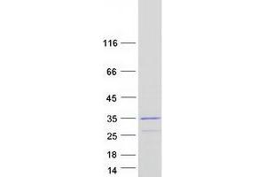 Validation with Western Blot