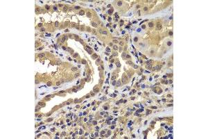 Immunohistochemistry (Paraffin-embedded Sections) (IHC (p)) image for anti-Proteasome (Prosome, Macropain) Subunit, beta Type, 8 (Large Multifunctional Peptidase 7) (PSMB8) (AA 163-272) antibody (ABIN6146321)