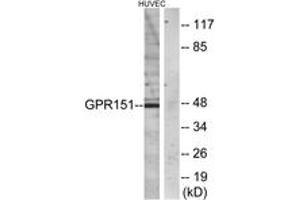 Western blot analysis of extracts from HuvEc cells, using GPR151 Antibody. (GPR151 抗体  (AA 276-325))