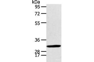 Western blot analysis of Human fetal brian tissue using CALB2 Polyclonal Antibody at dilution of 1:400 (Calretinin 抗体)