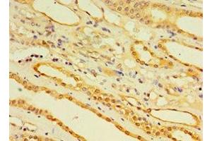 Immunohistochemistry of paraffin-embedded human kidney tissue using ABIN7151448 at dilution of 1:100 (EGLN3 抗体  (AA 1-120))