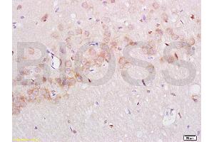 Immunohistochemistry (IHC) image for anti-Nerve Growth Factor Receptor (NGFR) (AA 301-400) antibody (ABIN725660)