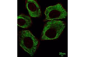 Immunofluorescent analysis of A549 cells, using TBB5 Antibody (ABIN387758 and ABIN2838008). (TUBB 抗体)