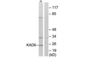 Western blot analysis of extracts from Jurkat cells, using KAD6 Antibody. (KAD6 抗体  (AA 11-60))