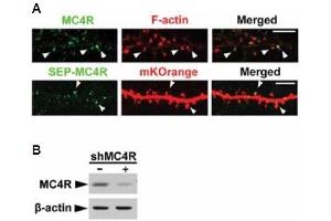anti-Melanocortin 4 Receptor (MC4R) (AA 6-20), (Extracellular) antibody