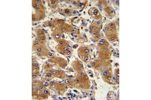 Immunohistochemistry (Paraffin-embedded Sections) (IHC (p)) image for anti-Collagen, Type VI, alpha 1 (COL6A1) (AA 831-858), (C-Term) antibody (ABIN390513)