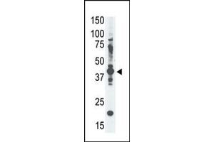 Western Blotting (WB) image for anti-Melanoma Antigen Family A, 4 (MAGEA4) (N-Term) antibody (ABIN358647) (MAGEA4 抗体  (N-Term))