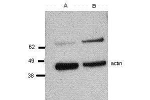 Image no. 1 for anti-Perforin 1 (Pore Forming Protein) (PRF1) antibody (ABIN477313) (Perforin 1 抗体)