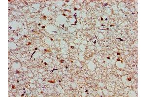 Immunohistochemistry (IHC) image for anti-Solute Carrier Family 25 (Mitochondrial Carrier, Aralar), Member 12 (Slc25a12) (AA 202-317) antibody (ABIN7146350)