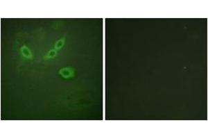 Immunofluorescence analysis of HeLa cells, using TUSC5 Antibody. (TUSC5 抗体  (AA 1-50))