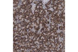 Immunohistochemical staining of human pancreas with C6orf120 polyclonal antibody  shows strong cytoplasmic positivity in granular pattern in exocrine pancreas. (C6ORF120 抗体)