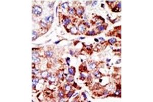 Image no. 2 for anti-Protein Inhibitor of Activated STAT, 2 (PIAS2) (C-Term) antibody (ABIN356767) (PIAS2 抗体  (C-Term))