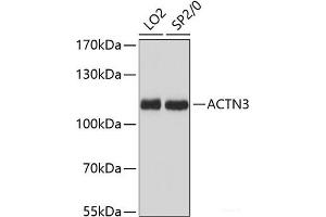 Western blot analysis of extracts of various cell lines using ACTN3 Polyclonal Antibody at dilution of 1:3000. (ACTN3 抗体)
