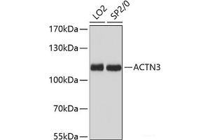 Western blot analysis of extracts of various cell lines using ACTN3 Polyclonal Antibody at dilution of 1:3000.