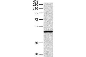 Western blot analysis of Mouse fat tissue, using INHBA Polyclonal Antibody at dilution of 1:1000 (INHBA 抗体)