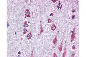 Anti-RAPSN / RAPSYN antibody IHC of human brain, cortex. (RAPSN 抗体  (AA 399-412))