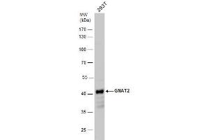 WB Image GNAT2 antibody detects GNAT2 protein by western blot analysis. (GNAT2 抗体  (Center))