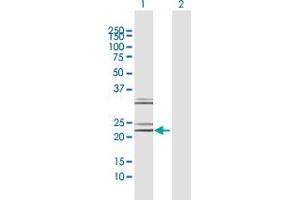Western Blot analysis of NTF4 expression in transfected 293T cell line by NTF4 MaxPab polyclonal antibody. (Neurotrophin 4 抗体  (AA 1-210))