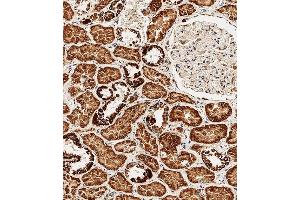 Immunohistochemistry (Paraffin-embedded Sections) (IHC (p)) image for anti-Branched Chain Keto Acid Dehydrogenase E1, beta Polypeptide (BCKDHB) (AA 41-70), (N-Term) antibody (ABIN654629)