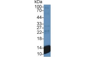Western Blot; Sample: Human Platelet lysate; Primary Ab: 300 Mouse Anti-Human bTG Antibody Second Ab: 0. (CXCL7 抗体  (AA 59-128))