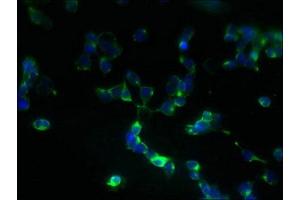 Immunofluorescent analysis of 293T cells using ABIN7162554 at dilution of 1:100 and Alexa Fluor 488-congugated AffiniPure Goat Anti-Rabbit IgG(H+L) (ZDHHC5 抗体  (AA 231-500))