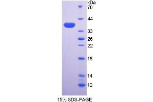 SDS-PAGE analysis of Mouse ALPL Protein. (ALPL 蛋白)