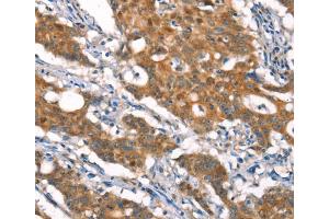 Immunohistochemistry (IHC) image for anti-Cylindromatosis (Turban Tumor Syndrome) (CYLD) antibody (ABIN2432904) (CYLD 抗体)