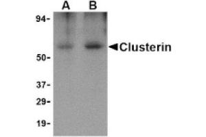 Image no. 1 for anti-Clusterin (CLU) (Isoform 1) antibody (ABIN265125) (Clusterin 抗体  (Isoform 1))