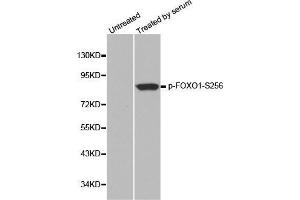 Western blot analysis of extracts from 293 cells, using phospho-FOXO1-S256 antibody.