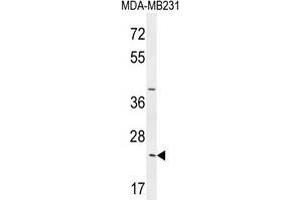 SYCE2 Antibody (N-term) western blot analysis in MDA-MB231 cell line lysates (35 µg/lane). (SYCE2 抗体  (N-Term))