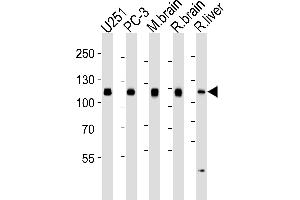 Western blot analysis of lysates from , PC-3 cell line, mouse brain, rat brain and liver tissue lysates (from left to right), using USP5 Antibody (ABIN1944895 and ABIN2838537). (USP5 抗体)