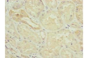 Immunohistochemistry of paraffin-embedded human kidney tissue using ABIN7154838 at dilution of 1:100 (NYS48/HAUS8 抗体  (AA 166-410))