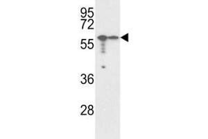 Western blot analysis of VIM antibody and A2058, A375 lysate. (Vimentin 抗体  (AA 152-181))