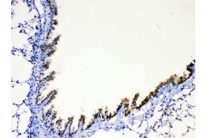 IHC analysis of AGRP using anti-AGRP antibody . (AGRP 抗体  (AA 82-131))