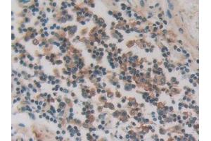 Immunohistochemistry (IHC) image for anti-Protein Kinase (CAMP-Dependent, Catalytic) Inhibitor gamma (PKIG) (AA 1-76) antibody (ABIN7442987)