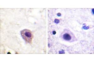 P-peptide - + (DRP2 抗体  (pThr514))