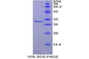 SDS-PAGE analysis of Mouse Protein Kinase C zeta Protein. (PKC zeta 蛋白)