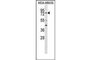 Western blot analysisof RFX3 Antibody (C-term) in MDA-MB435 cell line lysates (35ug/lane). (RFX3 抗体  (C-Term))