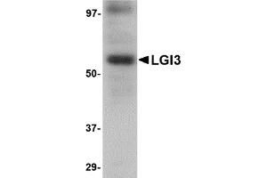 Western Blotting (WB) image for anti-Leucine-Rich Repeat LGI Family, Member 3 (LGI3) (Middle Region) antibody (ABIN1030983) (LGI3 抗体  (Middle Region))