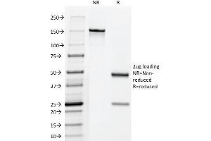 SDS-PAGE Analysis Purified hCG Mouse Monoclonal Antibody (HCGab/52). (CGA (HCG-Alpha) & CGB (HCG-Beta) 抗体)