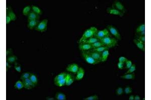 Immunofluorescent analysis of HepG2 cells using ABIN7152590 at dilution of 1:100 and Alexa Fluor 488-congugated AffiniPure Goat Anti-Rabbit IgG(H+L) (Fascin 抗体  (AA 2-187))