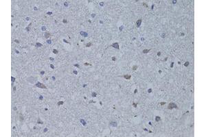 Immunohistochemistry of paraffin-embedded rat brain using BDNF antibody (ABIN4903035) at dilution of 1:100 (40x lens). (BDNF 抗体)