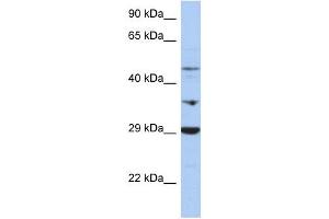 PDK3 antibody used at 1 ug/ml to detect target protein. (PDK3 抗体  (Middle Region))