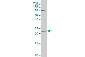RGS19 polyclonal antibody (A02), Lot # 050926JC01.