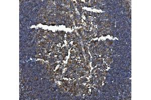 IHC analysis of CSF2RB using anti-CSF2RB antibody (ABIN7601088).