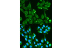 Immunofluorescence analysis of HeLa cell using FABP4 antibody. (FABP4 抗体)